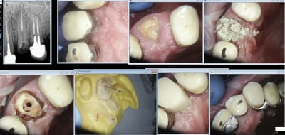 Hely 3 d6ardv - Eugenol