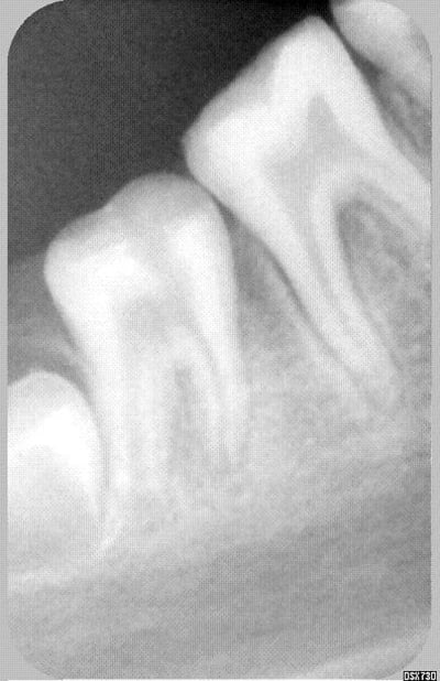 Hihi  f6hapz - Eugenol