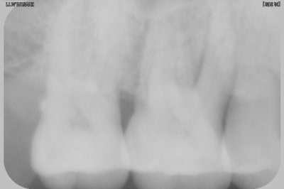 Hmed jzlt38 - Eugenol