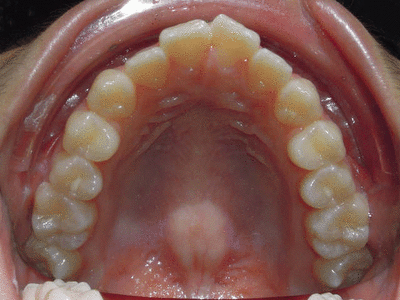 Horizontalflip1 stkbkq - Eugenol