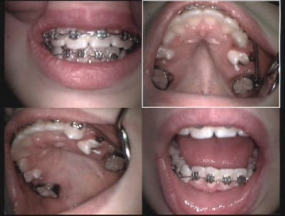 Huit mois gnxcdm - Eugenol