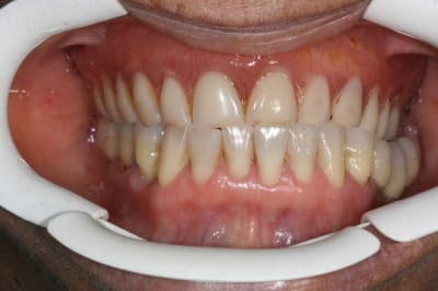 Image1 erc7iu - Eugenol