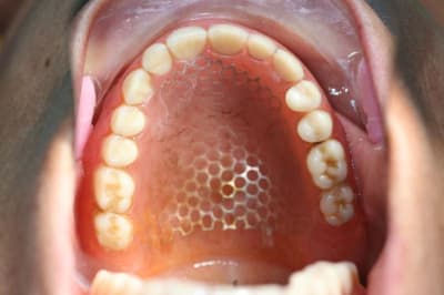 Image2 tqz6rg - Eugenol