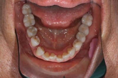 Image3 pldys4 - Eugenol