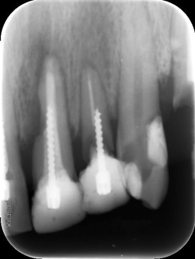 Image 11 iml4kw - Eugenol