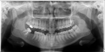 Image 47 pano xkpbzv - Eugenol