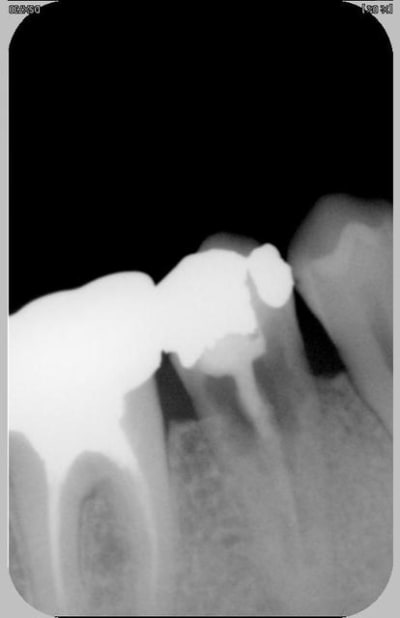 Image radio o5ency - Eugenol