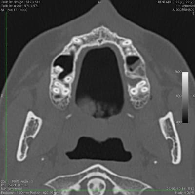 Image suspecte 4 - Eugenol