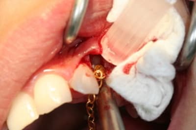 Img 0338 oytjcx - Eugenol