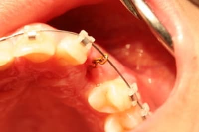 Img 0526 e3vtvo - Eugenol