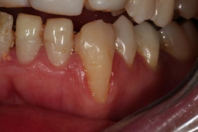 Img 1528 hqumsn - Eugenol