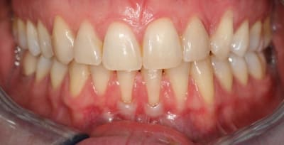 Img 6734 wcdndp - Eugenol