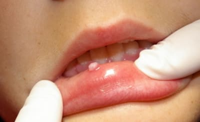 Imgp1300 ofgbqs - Eugenol