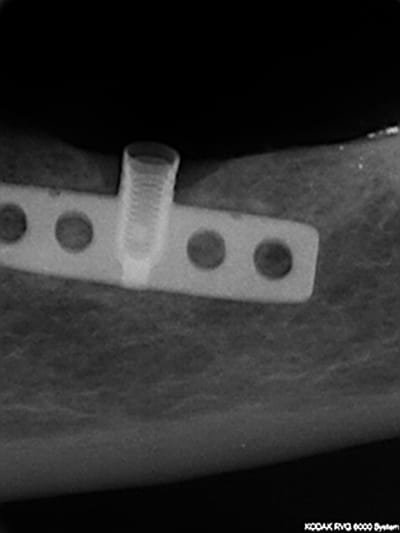 Implant rzqlzb - Eugenol