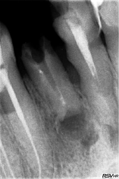 Incisive fun d0rzol - Eugenol