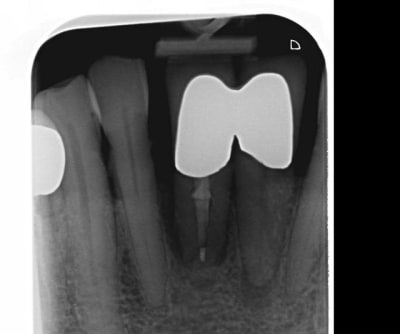 Inf1 qru8fi - Eugenol