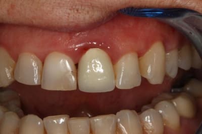 Inflammation 21 mgqr6i - Eugenol