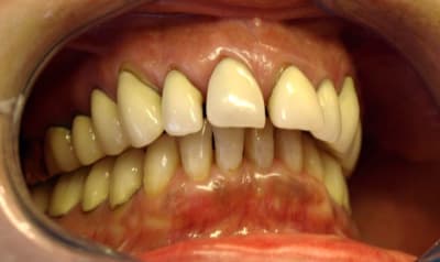 Initial2 d3ssiy - Eugenol