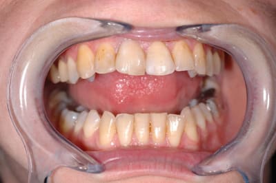 Initial bcujqz - Eugenol