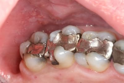 Initial nzkgtl - Eugenol