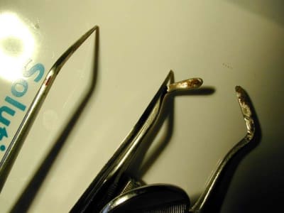 Intruments après stérilsation tndpp7 - Eugenol