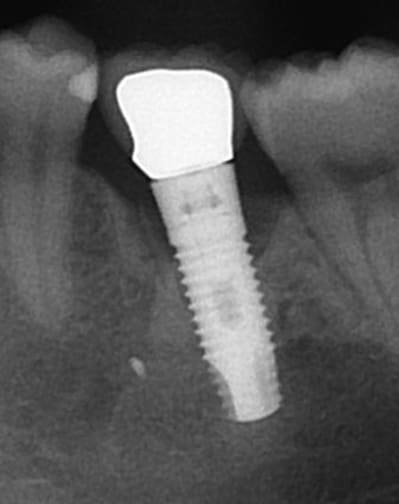 Isjupn6hi8aq2w7bebns - Eugenol