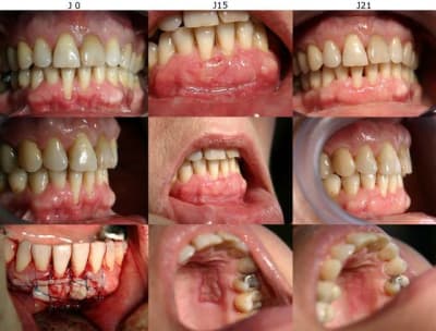 J0 j15 j21 urxgbr - Eugenol
