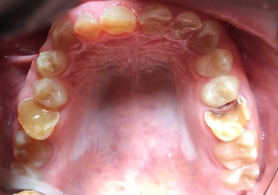 Jacpetpcfe8hwuwph8zd - Eugenol