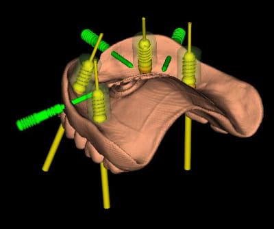 Jeu b2mtox - Eugenol