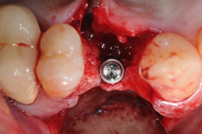 Jfgydh22mw3epo3ezcfv - Eugenol
