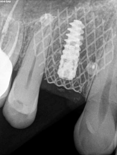 Jvnrxzkmdy3tlngp7ixq - Eugenol