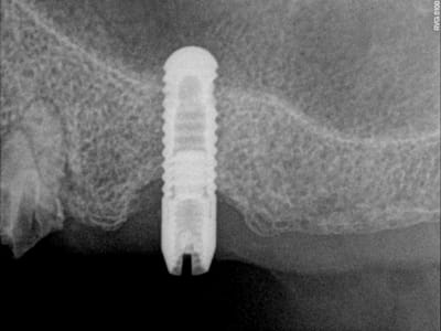 Jy0z149p47ydyvjo300h - Eugenol