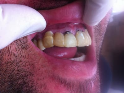 K 2 a7lade - Eugenol