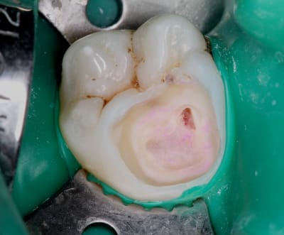 Kcqcsji7rry1d8402jah - Eugenol