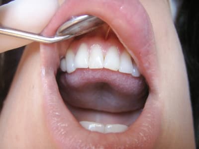 Kem inf ap neluwo - Eugenol