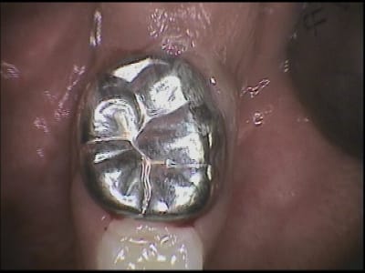 Ketucia um4two - Eugenol