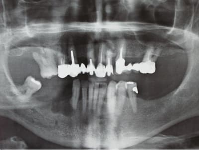 Kezac psqvdb - Eugenol