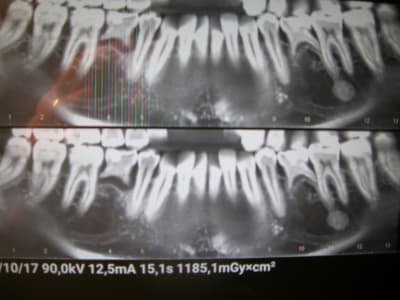 Knsotdojsabiljb5gp21 - Eugenol