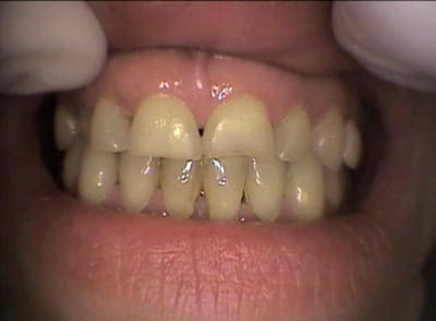 Lar1 irffbv - Eugenol