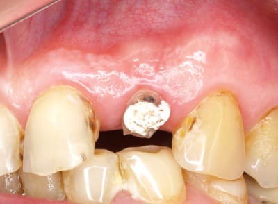 Le 25.11 - Eugenol