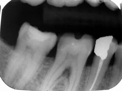 Les inter wk5ngw - Eugenol