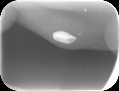 Levre eboerx - Eugenol