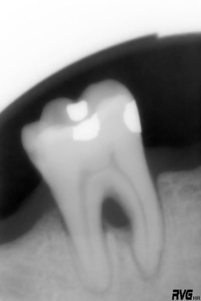 Lionel ex51ry - Eugenol