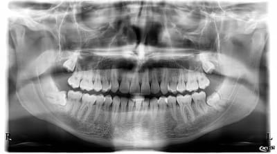 Lynyvjwvwjanfni2avfv - Eugenol