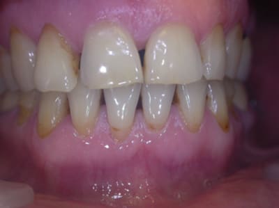 Madame t1 an2mqm - Eugenol