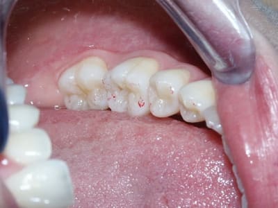 Mandgauche appbvn - Eugenol