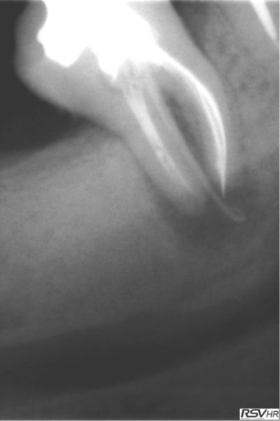 Marroux1 vwebgp - Eugenol