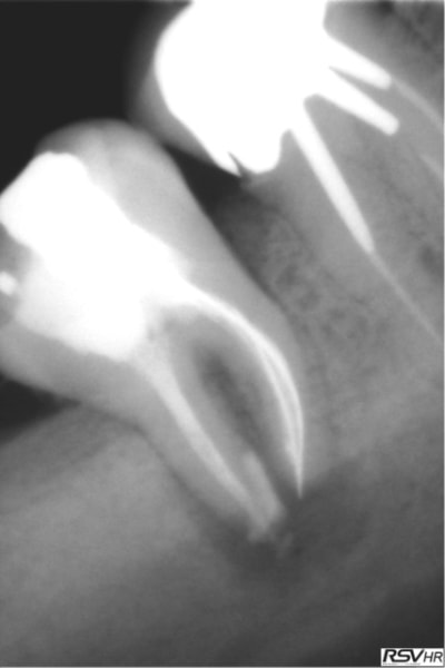 Marroux2 mfecxv - Eugenol