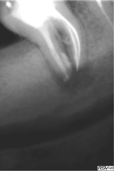 Marroux3 sb5xp3 - Eugenol