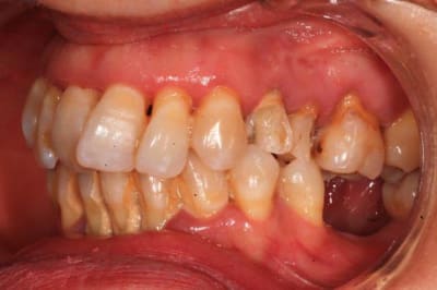 Mars2016 073 co7y56 - Eugenol